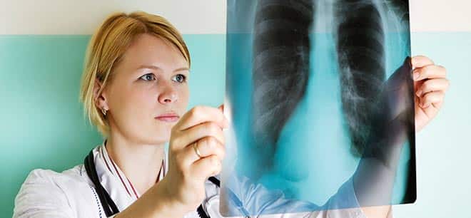 A doctor looking at an x-ray of the lungs