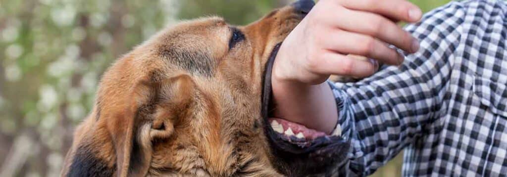 Man's arm being bitten by a dog